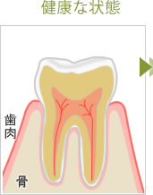 健康な状態